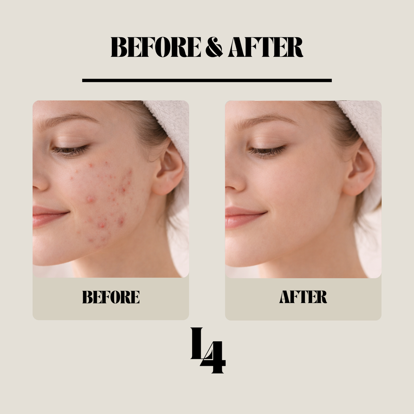 Lane4™ Hydrocolloid Acne Patch Roll
